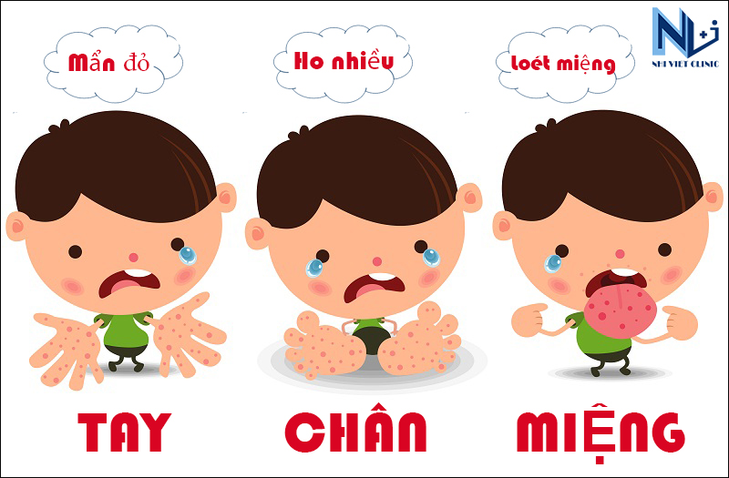 Phòng chống bệnh Tay Chân Miệng